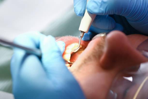 Best Emergency Treatment for Jaw Pain or Injury in Oakland, SC